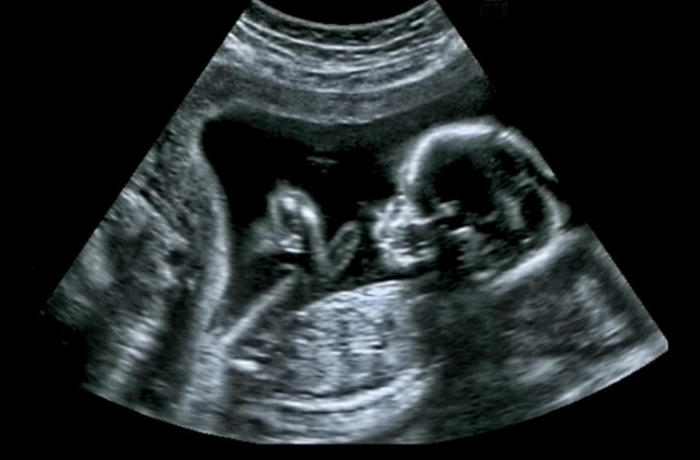 Ультразвуковая диагностика в акушерстве и гинекологии